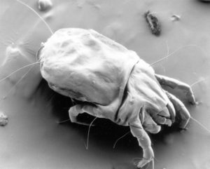 Female Dust Mite in Black and White photography