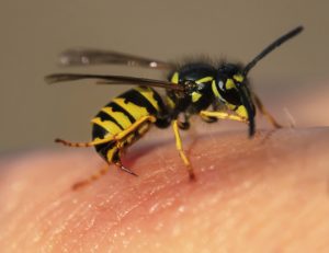 wasp stinging man